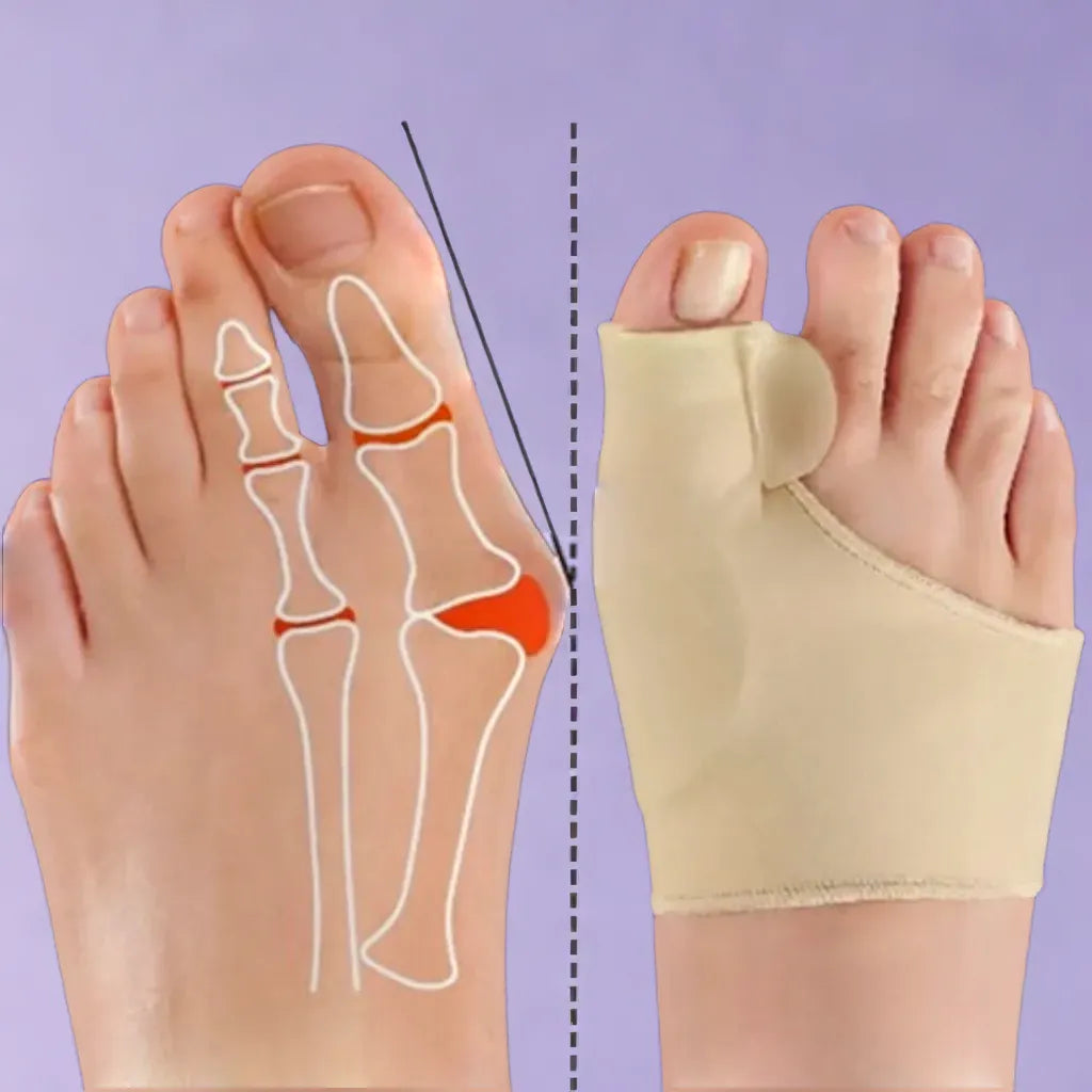 FlexiPro™ | Correcteur d'Hallux Valgus - Elixirios