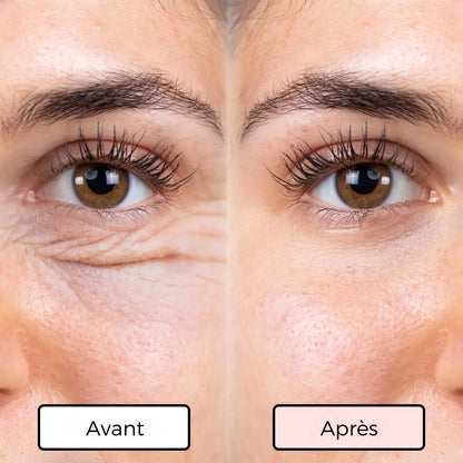 LumaLiss | Anti-poches & anti-rides + 1 SÉRUM OFFERT