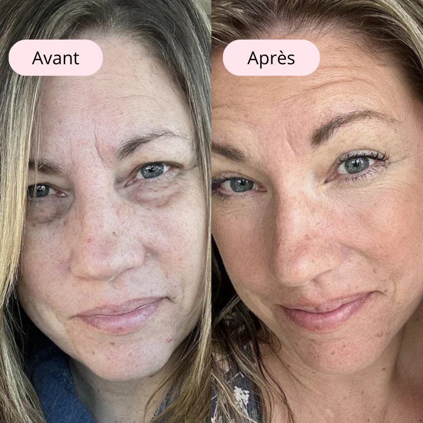 LumaLiss | Anti-poches & anti-rides + 1 SÉRUM OFFERT